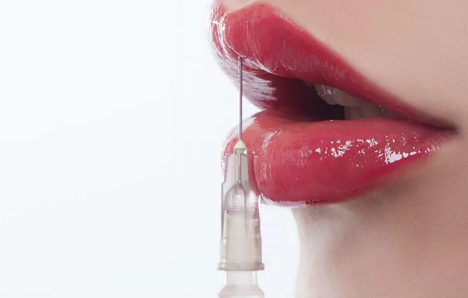 Saiba onde fazer preenchimento labial e o que avaliar