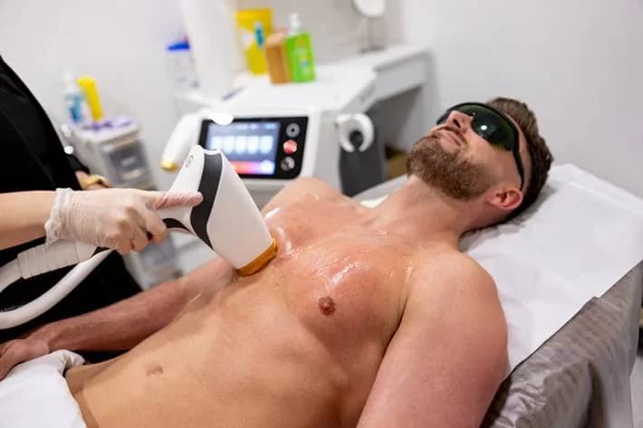 Depilação masculina: Tendência de autocuidado